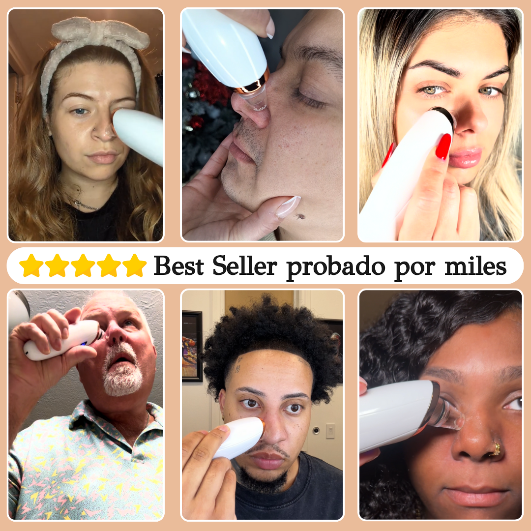 Nuvéra™ Extractor profesional de puntos negros